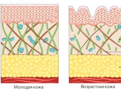Помогает ли гиалуроновая кислота вернуть молодость
