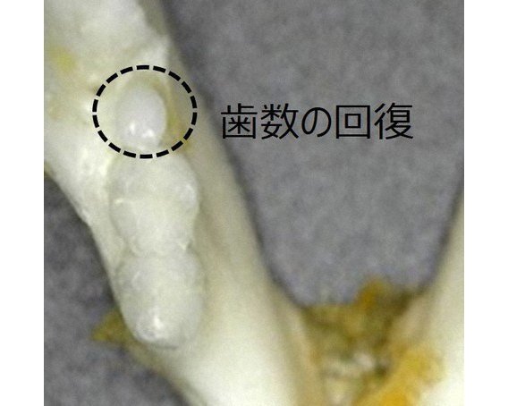 В Японии разработали первое в мире лекарство для восстановления роста зубов